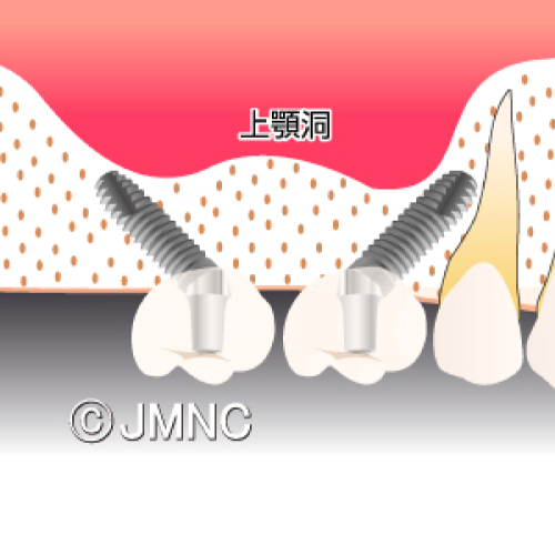 特殊な症例にも柔軟に対応